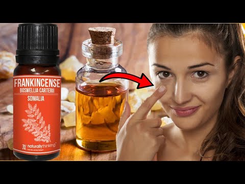 Frankincense Oil Uses & Benefits For Healing The