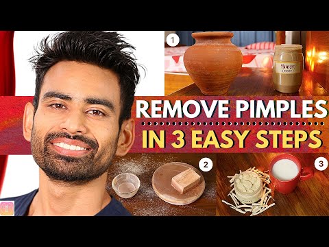 ULTIMATE Ayurvedic Routine to Get Rid of Pimples & Acne Permanently (Men &