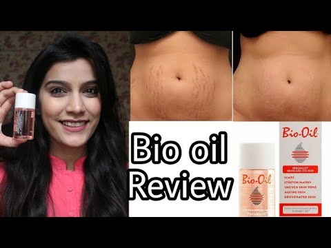 Bio Oil Review In Hindi | Remove Stretch Marks/Scars | Super Style