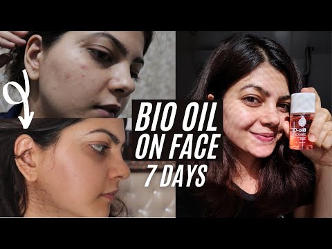 I applied Bio Oil on my face for 7 days! How to remove pimples in 7