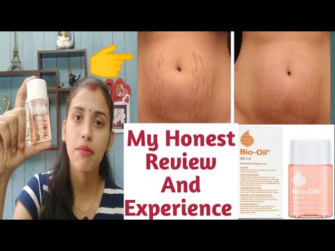 Bio Oil Review in Hindi | My Honest Review and Experience | Rj